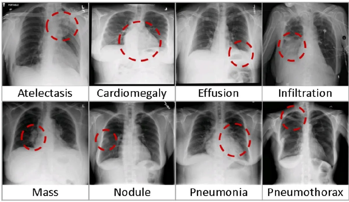 Image Classification Project
